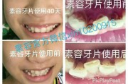 微博黄v如何认证
，牙齿上有黄渍如何去除？牙齿发黄怎么办？