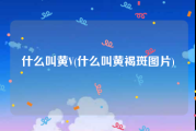 什么叫黄V(什么叫黄褐斑图片)