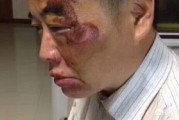 微博上的各种骗子
，为什么微博上捐款30万给电瓶车男的骗子居然有人会相信？