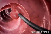 肠镜检查怎么做的过程视频(肠镜检查怎么做的过程视频讲解)