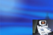 超声科宣传视频(超声科宣传视频文案)