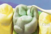 固定蜡型制作的视频(蜡型的制作方法与步骤)