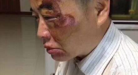 为什么微博上捐款30万给电瓶车男的骗子居然有人会相信？