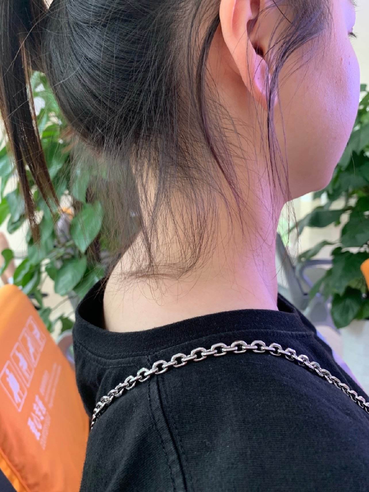 富贵包做手术的视频(医院治疗富贵包手术视频)