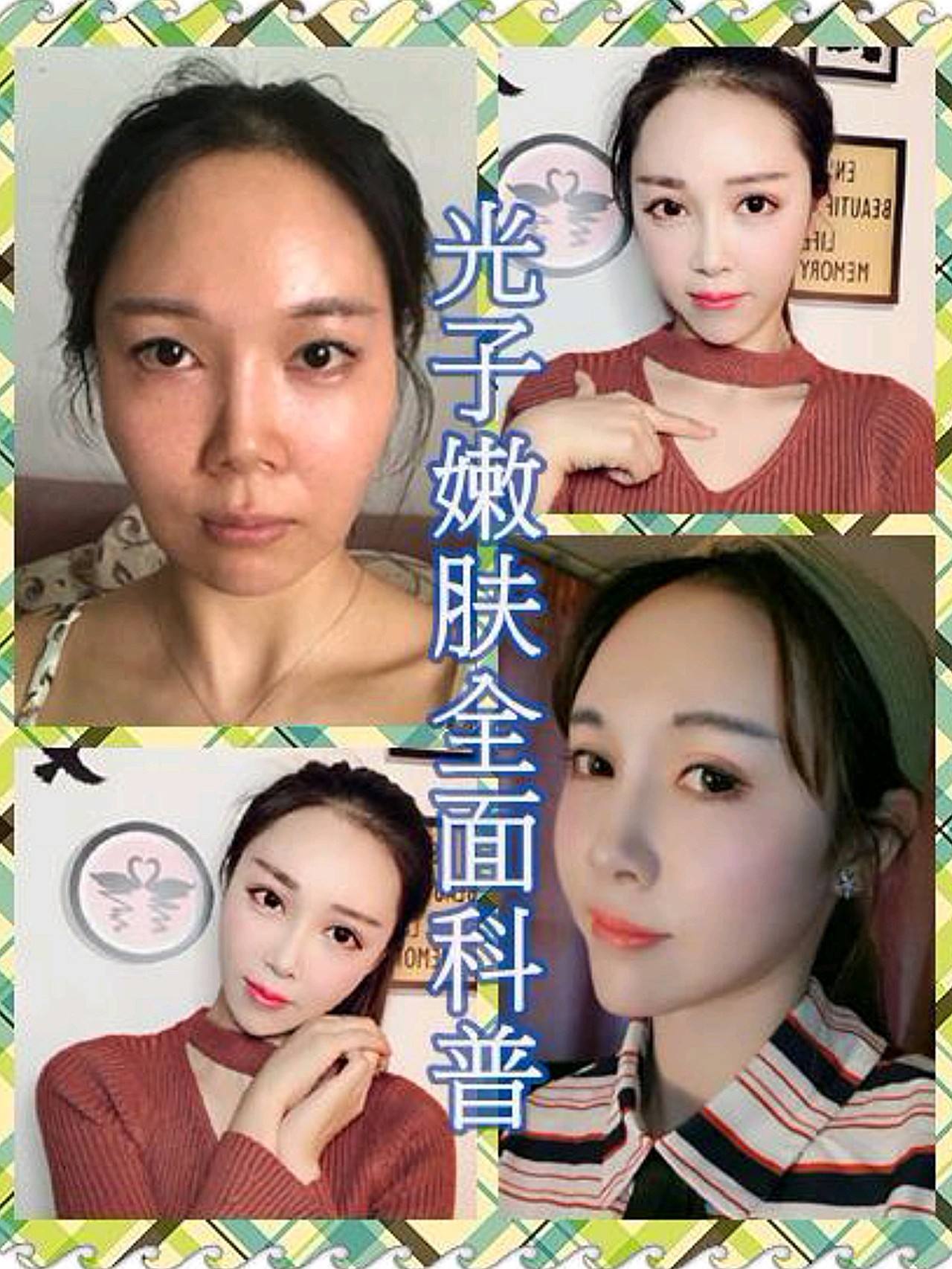 光子嫩肤怎么做视频(做光子嫩肤的全过程视频)